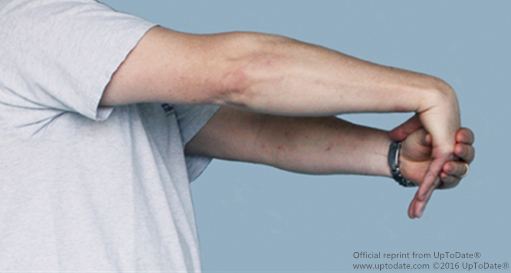 【健康知識】テニス肘について